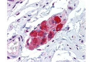 Anti-TRPV2 antibody IHC of human small intestine, submucosal plexus. (TRPV2 anticorps  (AA 595-764))