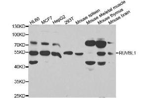 Western blot analysis of extracts of various cell lines, using RUVBL1 antibody. (RUVBL1 anticorps  (AA 1-240))