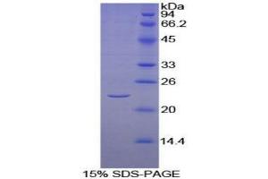 SDS-PAGE analysis of Human KLRC2 Protein. (KLRC2 Protéine)
