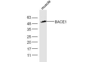 Mouse muscle lysates probed with Rabbit Anti-BACE1 Polyclonal Antibody, Unconjugated  at 1:5000 for 90 min at 37˚C. (BACE1 anticorps  (AA 401-501))