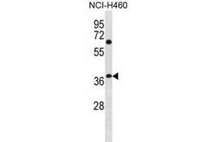 NHLRC3 Antibody (C-term) (ABIN1881580 and ABIN2838947) western blot analysis in NCI- cell line lysates (35 μg/lane). (NHLRC3 anticorps  (C-Term))