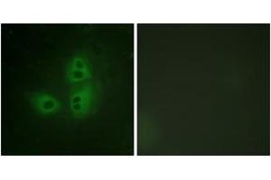 Immunofluorescence analysis of HeLa cells, using nNOS (Ab-852) Antibody.