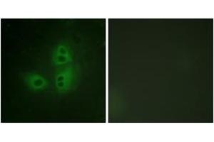 Immunofluorescence analysis of HeLa cells, using nNOS (Ab-852) Antibody. (NOS1 anticorps  (AA 818-867))
