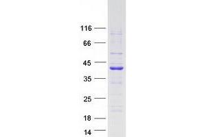 Validation with Western Blot