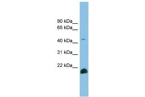 WB Suggested Anti-TGFB2 Antibody Titration: 0.