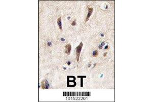 anti-tyrosine Kinase with Immunoglobulin-Like and EGF-Like Domains 1 (TIE1) (AA 12-42) antibody