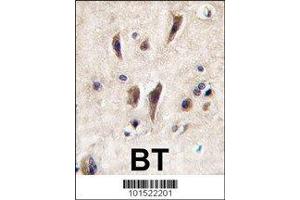 IHC analysis of FFPE human brain tissue stained with TIE1 antibody (TIE1 anticorps  (AA 12-42))