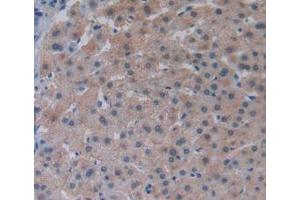 Figure. (LPCAT3 anticorps  (AA 122-233))