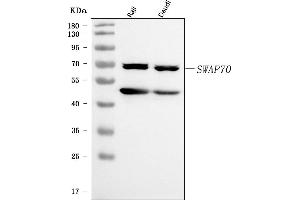 Western blot analysis of SWAP70 using anti-SWAP70 antibody (ABIN7600201).