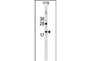 Western blot analysis in Y79 cell line lysates (35ug/lane). (DNAJC5 anticorps  (AA 52-80))