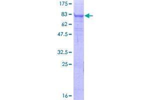Image no. 1 for Transmembrane Protease, serine 6 (TMPRSS6) (AA 1-461) protein (GST tag) (ABIN1323098)