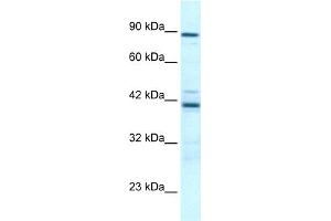 WB Suggested Anti-TBX5 Antibody Titration:  0. (T-Box 5 anticorps  (Middle Region))