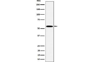 Western blot analysis of PNK / PNKP expression in Jurkat cell lysate.