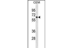 FCGR3A Antibody ABIN1539896 western blot analysis in CEM cell line lysates (35 μg/lane). (FCGR3A anticorps  (AA 60-88))