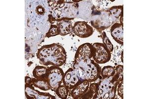 Immunohistochemical staining of human placenta with CRIP2 polyclonal antibody  shows strong cytoplasmic and membranous positivity in trophoblastic cells at 1:500-1:1000 dilution. (CRIP2 anticorps)