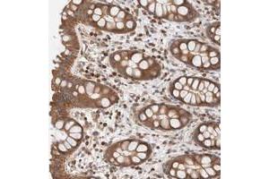 Immunohistochemical staining of human rectum with RP5-1000E10. (SIKE1 anticorps)