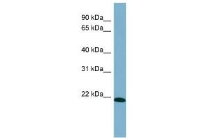 WB Suggested Anti-TIRAP Antibody Titration: 0. (TIRAP anticorps  (Middle Region))
