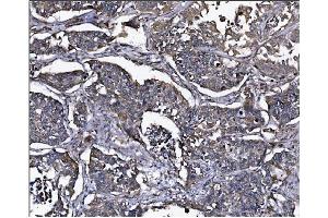IHC analysis of ERAP2 using anti-ERAP2 antibody (ABIN7599949).
