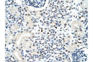 SSB antibody was used for immunohistochemistry at a concentration of 4-8 ug/ml to stain Epithelial cells of renal tubule (arrows) in Human Kidney. (SSB anticorps)