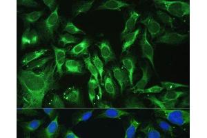 Immunofluorescence analysis of U-2 OS cells using OGN Polyclonal Antibody at dilution of 1:100. (OGN anticorps)