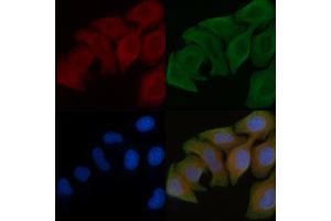 ABIN6258556 and ABIN6275402 staining Hela cells by IF/ICC. (POTEB anticorps  (C-Term))