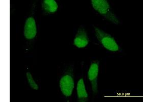 Immunofluorescence of monoclonal antibody to PRPH on HeLa cell.