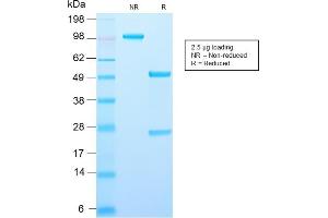 SDS-PAGE Analysis Purified Recombinant Rabbit Monoclonal Antibody (AMACR/2748R).