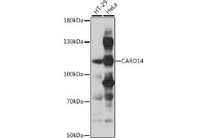 Western blot analysis of extracts of various cell lines, using C antibody (ABIN7266126) at 1:1000 dilution. (CARD14 anticorps  (AA 200-500))