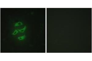 Immunofluorescence (IF) image for anti-Cytochrome P450, Family 2, Subfamily J, Polypeptide 2 (CYP2J2) (AA 231-280) antibody (ABIN2889947)