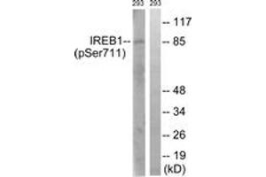 Western blot analysis of extracts from 293 cells treated with insulin 0. (Aconitase 1 anticorps  (pSer711))