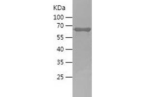 Western Blotting (WB) image for Growth Associated Protein 43 (GAP43) (AA 1-238) protein (His-IF2DI Tag) (ABIN7123204)