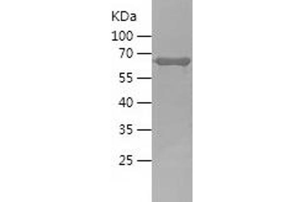 GAP43 Protein (AA 1-238) (His-IF2DI Tag)