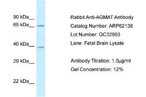 Western Blotting (WB) image for anti-Agmatine Ureohydrolase (Agmatinase) (AGMAT) (N-Term) antibody (ABIN2789033) (AGMAT anticorps  (N-Term))
