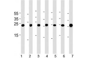 Cebpd antibody western blot analysis in 1) A549, 2) HeLa, 3) NCI-H460, 4) U-937, 5) mouse NIH3T3 cell line, rat 6) lung and 7) testis tissue lysate. (CEBPD anticorps  (AA 161-189))