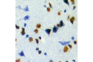Immunohistochemical analysis of JMJD6 staining in mouse brain formalin fixed paraffin embedded tissue section.