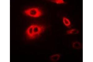 Immunofluorescent analysis of RIPK2 staining in MCF7 cells. (RIPK2 anticorps)