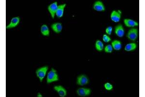 Immunofluorescence staining of Hela cells with ABIN7159009 at 1:133, counter-stained with DAPI. (MARVELD3 anticorps  (AA 1-189))