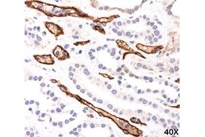 IHC testing of FFPE human kidney transplant tissue (40X) stained with Complement 4d / C4d antibody (C4D204). (Complement C4d anticorps)