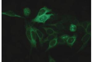 Immunocytochemistry staining of alpha-tubulin in Hep-2 cells using mouse monoclonal antibody TU-16 (diluted 1:400), detected with GAM IgG-Alexa Fluor488 (diluted 1:200, green).