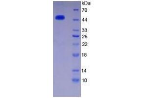 SDS-PAGE of Protein Standard from the Kit (Highly purified E. (SERPINC1 Kit CLIA)