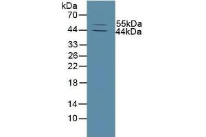 Detection of MMP13 in Mouse Skin Tissue using Polyclonal Antibody to Matrix Metalloproteinase 13 (MMP13) (MMP13 anticorps  (AA 290-468))