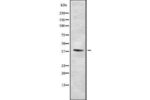 Western blot analysis SETD7 using Jurkat whole cell lysates (SETD7 anticorps  (Internal Region))