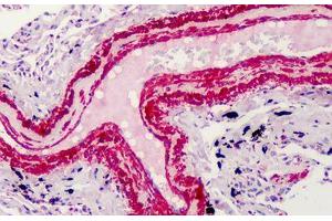 Human Smooth Muscle: Formalin-Fixed, Paraffin-Embedded (FFPE) (Smooth Muscle Actin anticorps  (N-Term))