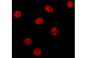 ABIN6274375 staining HT29 cells by IF/ICC. (NAB2 anticorps  (C-Term))