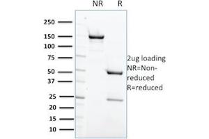 SDS-PAGE Analysis Purified PTPN6 Mouse Monoclonal Antibody (CPTC-PTPN6-2). (SHP1 anticorps)