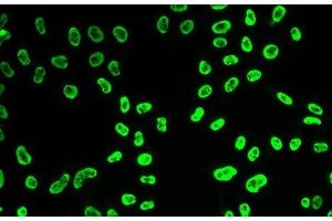 Immunofluorescence analysis of HeLa cells using SNRPA Polyclonal Antibody (SNRPA1 anticorps)