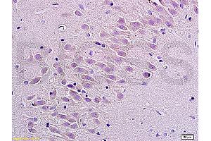 Formalin-fixed and paraffin embedded rat brain labeled with Anti Substance P Receptor/NK1R Polyclonal Antibody, Unconjugated (ABIN724385) at 1:200 followed by conjugation to the secondary antibody Goat Anti-Rabbit IgG, PE conjugated used at 1:200 dilution for 40 minutes at 37°C.