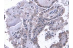 IHC-P analysis of Human Thyroid Tissue, with DAB staining. (LRP1B anticorps  (AA 31-194))