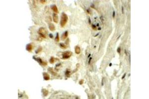 Immunohistochemical staining of human lung cells with TYW1 polyclonal antibody  at 5 ug/mL. (TYW1 anticorps  (C-Term))