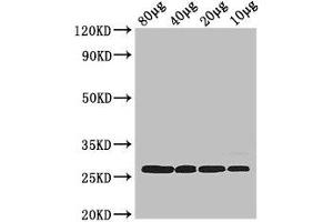 Western Blot Positive WB detected in: Rosseta bacteria lysate at 80 μg, 40 μg, 20 μg, 10 μg All lanes: rpsB antibody at 2. (rPSB (AA 2-241) anticorps)